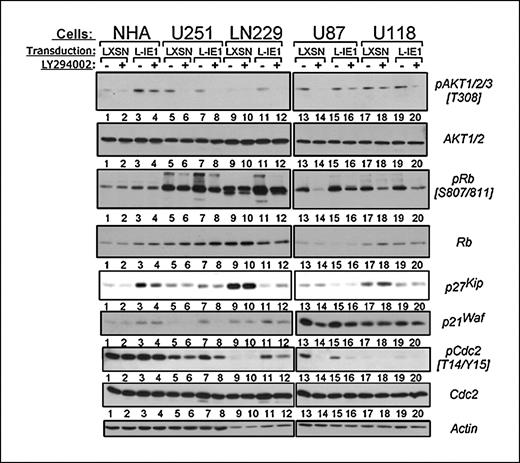 Figure 6. PI3K-independent activation of cell cycle regulatory proteins by IE1. Selected mass populations were synchronized for 48 h by serum starvation in the presence of 20 μmol/L LY294002 PI3K inhibitor or vehicle control during the second 24 h. Protein lysates (15 μg) were analyzed by immunoblotting for AKT and Rb phosphorylation or protein levels and expression of CDK inhibitors p27Kip and p21Waf, and standardized by actin signals as loading controls.