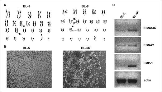 Figure 1. Cytogenetic and morphologic analysis of BL lines and differential expression of EBV genes in latency type I and III BL lines. A, cytogenetic analysis of BL lines BL-5 and BL-8 reveals the characteristic t8:14 c-MYC translocation. Arrows point to translocated chromosomes. B, bright-field photomicrograph of BL-5 and BL-5R cells in culture. Magnification, ×100. BL-5 cells grow as a single-cell suspension, whereas BL-5R cells grow as macroscopic clumps, characteristic of LCLs. C, RT-PCR analysis of EBV-encoded EBNA3C, EBNA2, and LMP-1 mRNA levels in BL-5 and BL-5R cells. β-Actin mRNA level was analyzed as loading control. Agarose gels were exposed under UV light in a Bio-Rad Gel Doc 2000 imager and inverted images of DNA bands captured.