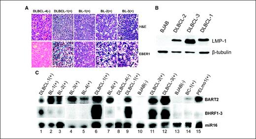 Figure 3. Differential expression of BHRF1-3 and BART2 miRNAs in primary unmanipulated clinical specimens. A, representative immunohistochemical analysis in primary unmanipulated clinical specimens. Endemic BLs (BL-1, BL-2, and BL-3) and primary DLBCLs (DLBCL-1 and DLBCL-4) were stained with H&E (top row) or stained for EBER1 (bottom row). Positive staining to EBV/EBER is visualized as dark blue spots. (−), EBV negative; (+), EBV positive. B, Western blot of LMP-1 protein in primary DLBCLs. EBV+ DLBCL-1, DLBCL-2, and DLBCL-3 were probed with specific antibody to LMP-1. An EBV− BL line, BJAB, was used as a negative control, and the same membrane was also probed with β-tubulin for a loading control. C, RPA analysis of BHRF1-3 and BART2 miRNA expression in primary EBV+ BLs (BL-1, BL-2, BL-3, BL-4, and BL-6), EBV+ primary DLBCLs (DLBCL-1, DLBCL-2, and DLBCL-3), a primary EBV+ PEL specimen (PELmo1), and an established EBV+ PEL line (BC-1). EBV− DLBCL-4 and BJAB were also analyzed as negative controls, and miR16 as a loading control.
