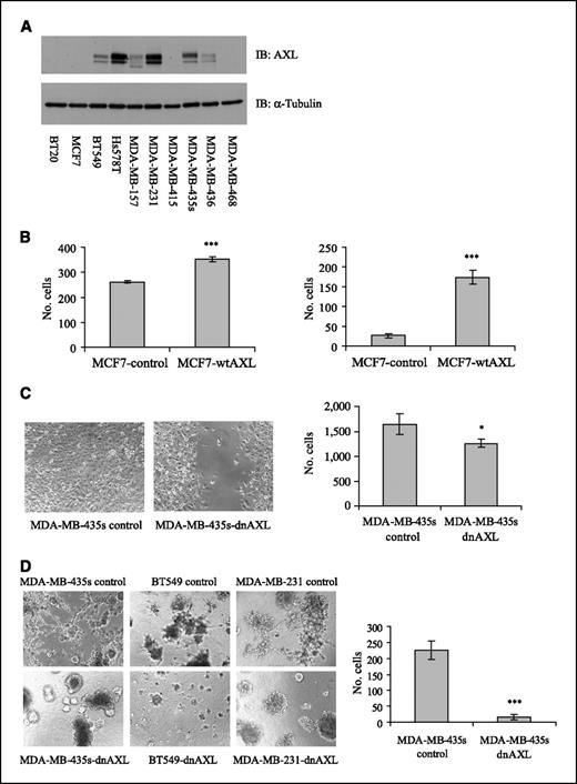 Figure 1. AXL expression correlates with motility and invasivity of breast cancer cells. A, expression of AXL protein in invasive and noninvasive breast cancer cells. Whole-cell lysates were used to detect the protein level of AXL by immunoblot analysis (top) with α-tubulin as loading control (bottom). B, motility (left) and invasivity (right) of MCF7 breast cancer cells stably overexpressing wtAXL or control vector were analyzed by Boyden chamber migration and invasion assays, respectively, for 36 h toward medium containing 10% FCS as a chemoattractant. Bars, ±SD (n = 3). C, the motility of cells was analyzed by cell monolayer wound healing assay (left) and Boyden chamber migration assay (right). In cell monolayer wound healing assay, cells were allowed to migrate into the wound area for 3 d. Cell migration was visualized at 10× magnification. In Boyden chamber migration assay, motility of cells was analyzed for 36 h toward medium containing 10% FCS as a chemoattractant. Bars, ±SD (n = 3). D, the invasivity of cells was analyzed by Matrigel outgrowth assay (left) and Boyden chamber invasion assay (right). In Matrigel outgrowth assay, cells were plated on the surface of Matrigel. Colony outgrowth was visualized at 10× magnification. In Boyden chamber invasion assay, invasivity of cells was analyzed for 36 h toward medium containing 10% FCS as a chemoattractant. Bars, ±SD (n = 3). *, P < 0.05; ***, P < 0.001, compared with respective control group.