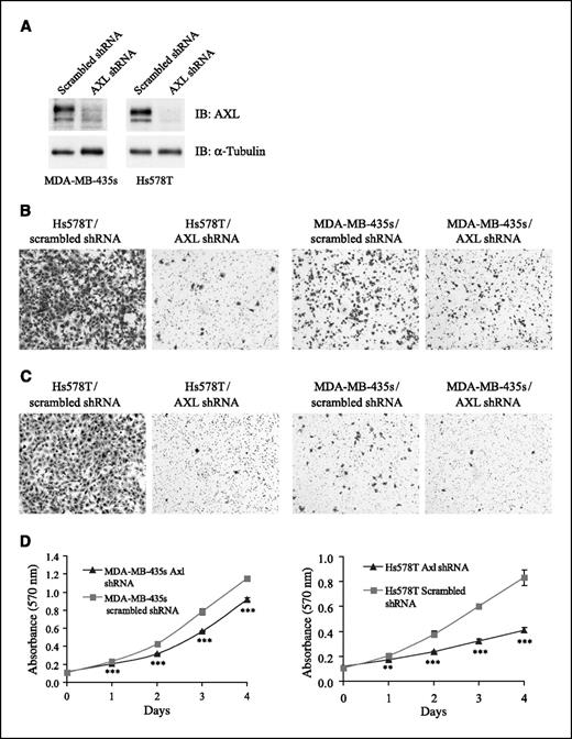 Figure 2. Effects of shRNA-mediated AXL expression knockdown on proliferation, motility, and invasivity of human breast cancer cells. A, expression of AXL protein in MDA-MB-435s and Hs578T cells stably expressing pRetrosuper-AXL-shRNA or pRetrosuper-scrambled-shRNA. Whole-cell lysates were used to detect the protein level of AXL by immunoblot analysis (top) with α-tubulin as loading control (bottom). B, motility of cells was analyzed by Boyden chamber migration assay for 12 h toward medium containing 10% FCS as a chemoattractant. The cells that had migrated to the lower surface were fixed and stained with crystal violet. Cells were visualized at 10× magnification. C, invasivity of cells was analyzed by Boyden chamber invasion assay, similarly as described above except for seeding the cells into the Matrigel-coated inserts, and cells were permitted to migrate for 36 h. D, comparison of cell proliferation by MTT assay. Bars, ±SD of absorbance at 570 nm (n = 3). **, P < 0.01; ***, P < 0.001, compared with scrambled shRNA–expressing cells.