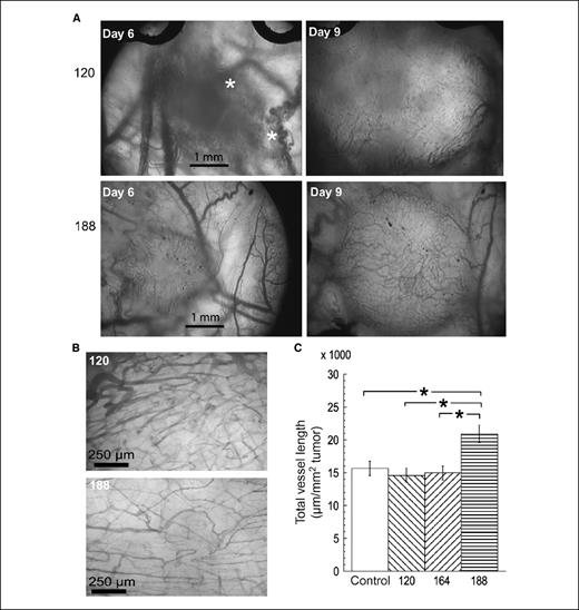 Figure 3. Vascular morphology of tumors growing in the dorsal skin flap window chambers in SCID mice. A, low-power (×2.5 objective) transmitted light images of tumors at 6 and 9 d after tumor transplantation. *, hemorrhage in the VEGF120-expressing tumor. Images show a well-vascularized center in the VEGF188-expressing tumor at day 9, as compared with the VEGF120-expressing tumor at the same time (see also Supplementary Fig. S2). B, high-power (×10 objective) images of VEGF120- and VEGF188-expressing tumors showing narrower vessels and a more regular arrangement of the vascular network in the VEGF188-expressing tumor. C, quantitative analysis of total vascular length in regions of interest such as those in B, for the whole group of tumors. Columns, mean for tumors in each group (n = 6–9); bars, SE. *, P < 0.05, significant differences between the groups. Total vascular length was significantly higher in VEGF188-expressing tumors than in the other tumor types (ANOVA followed by Tukey-Kramer HSD test).