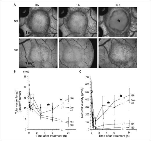 Figure 5. Response of the different tumor types growing in window chambers in SCID mice to a single dose of 30 mg/kg i.v. CA-4-P. A, typical low-power (×2.5 objective) images of VEGF120- and VEGF188-expressing tumors after CA-4-P treatment. There was a reduction in the visible vasculature at 1 h after treatment in both tumor types and extensive avascular regions in VEGF120- but not VEGF188-expressing tumors by 24 h (*). Supplementary Fig. S3 shows that the response of VEGF164 tumors was similar to VEGF120 tumors and the response of control tumors was similar to VEGF188 tumors. B and C, quantitative analysis of vascular length and red cell velocity for all tumor types. Points, mean for tumors in each group (n = 4–6); bars, SE. *, P < 0.05, curves for VEGF120- and VEGF164-expressing tumors were significantly different from those for VEGF188-expressing and control tumors over these regions (MANOVA with repeated measures).