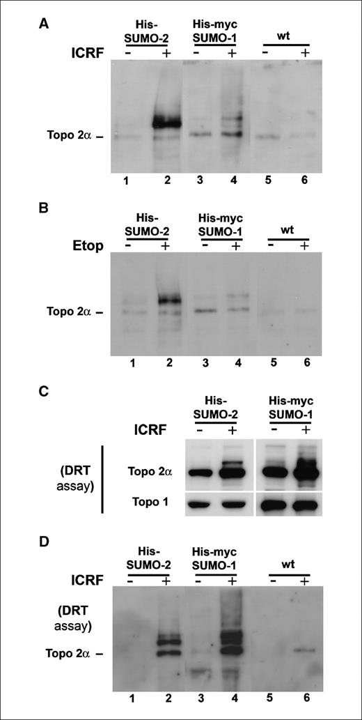 Figure 1. Topoisomerase 2 (Topo 2) inhibitors stabilize catalytically committed conjugates of topoisomerase IIα with SUMO-2/3. A, a similar number (∼20 × 106) of asynchronously growing (∼96% in interphase) HeLaHis-SUMO-2, HeLaHis-myc-SUMO-1, or HeLa wt cells was treated with 50 μg/mL ICRF-187 (+) or solvent alone (−) for 20 min. Cells were lysed in 6 mol/L guanidium-HCL buffer and processed for Ni2+-affinity purification of His-SUMO–conjugated forms. Purified forms were separated by SDS-PAGE, transferred to a nitrocellulose membrane, and probed with topoisomerase 2α–specific antibodies. B, experimental design was as delineated above except that cell lines were exposed to 25 μmol/L etoposide (+) for 20 min or solvent alone (−). C, HeLaHis-SUMO-2 and HeLaHis-myc-SUMO-1 cells exposed to ICRF-187(+) (50 μg/mL, 20 min) or solvent(−) were subjected to salt (350 mmol/L NaCl)–detergent extraction according to the DRT protocol; blots of gel resolved proteins present in the insoluble remnants were probed with antibodies specific for either topoisomerase 2α or topoisomerase 1; note that topoisomerase 2α, but not topoisomerase 1, is enriched in the insoluble fraction of ICRF-187(+) cells. D, HeLaHis-SUMO-2, HeLaHis-myc-SUMO-1, and HeLa wt cells were treated with ICRF-187(+) or solvent(−) and extracted according to the DRT protocol, as above, before affinity (Ni-NTA) purification of salt-detergent insoluble SUMO conjugates; shown are blots of gel resolved SUMO conjugates probed for topoisomerase 2α.