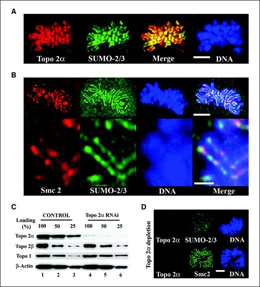 Figure 4. ICRF-187 induces concentration of SUMO-2/3 at mitotic chromosome cores/axes in a topoisomerase 2α–dependent fashion. A, cells exposed to ICRF-187 (50 μg/mL, 15 min) were costained for topoisomerase 2α and SUMO-2/3. Regions of colocalization of the two staining patterns are depicted in yellow in the merged image; DNA is stained with DAPI. Bar, 5 μm. B, colabeling of ICRF-187–treated cells for smc2 (condensin subunit) and SUMO-2/3; DNA is stained with DAPI. Bar, 5 μm. Bottom, high-magnification images; bar, 2 μm. C, protein extracts from HeLa cells that were either pseudodepleted (scramble sequence; controls) or depleted of topoisomerase 2α with specific small interfering RNA (topoisomerase 2α RNAi) were probed for topoisomerase 2α, topoisomerase 2β, topoisomerase 1, and β-actin (loading control) by Western blotting; to better judge the degree of specific depletion, different amounts of protein extract were loaded per experimental group (expressed in percentage). Note that only topoisomerase 2α is specifically depleted. D, cells depleted of topoisomerase 2α with specific small interfering RNA were given ICRF-187 and costained for either topoisomerase 2α and SUMO-2/3 (top) or topoisomerase 2α and smc 2 (bottom); DNA is stained with DAPI. Bar, 5 μm.