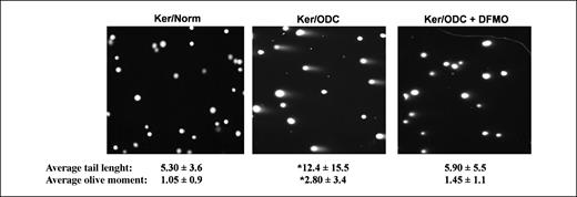 Figure 3. DNA damage induced by elevated ODC activity in primary keratinocytes. Primary keratinocytes were isolated from K6/ODC transgenic mice (Ker/ODC) and their normal littermates (Ker/Norm) and plated. Some of the Ker/ODC were treated with 3 mmol/L DFMO. Following 5 d in culture, keratinocytes were harvested, embedded in low-melting-point agarose, and processed for the alkaline comet assay as described in Materials and Methods. Each slide was stained with SYBR Green, photographed using a fluorescent microscope, and the average tail lengths ± SD were scored and analyzed using the Cometscore software to determine the average olive moments ± SD. *, P < 0.0001, significantly different compared with Ker/Norm or with DFMO-treated Ker/ODC.