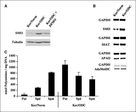 Figure 4. Elevated ODC activity induces SMO. A, after 3 d in culture, Ker/Norm, Ker/ODC, and Ker/ODC treated with 3 mmol/L DFMO were harvested. Immunoblot analysis of total cellular protein lysates in which blots were probed with an antibody specific for SMO and reprobed for tubulin as a control. B, RNA was prepared from Ker/Norm and Ker/ODC 3 d after isolation from the skin of K6/ODC transgenic mice and their normal littermates. RT-PCR was performed to analyze levels of SMO, SSAT, APAO, and AdoMetDC at the mRNA level. GAPDH mRNA was simultaneously monitored as an internal PCR control for each reaction. C, high-performance liquid chromatography analyses of total intracellular polyamine levels in Ker/Norm and Ker/ODC harvested 3 d in culture. Polyamines (Put, putrescine; Spd, spermidine; Spm, spermine) are expressed in nmol/mg DNA. Bars, SD.