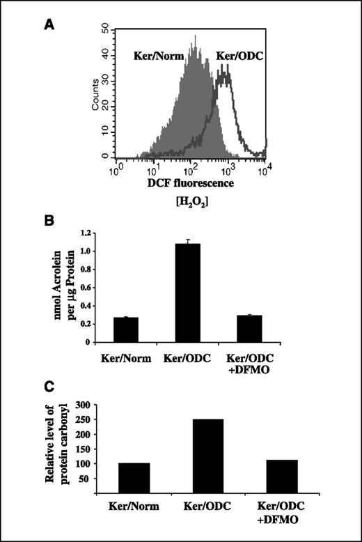 Figure 5. Elevated ODC activity leads to increased ROS generation. A, the levels of H2O2 production in Ker/Norm and Ker/ODC were compared using flow cytometry. Four days following culture, cells were incubated with 10 μmol/L CM-H2DCFdA at 37°C for 25 min, and fluorescence was measured using a BD FACS Canto II flow cytometer. X axis, fluorescent intensity; Y axis, cell number. Representative results of four experiments that gave similar results. B, 4 d following culture, Ker/Norm, Ker/ODC, and Ker/ODC treated with 3 mmol/L DFMO were harvested by freeze-thaw in PBS and nmol acrolein-lysine conjugates/mg protein was determined by direct ELISA assay. Bars, SD. C, relative level of protein carbonyl groups in Ker/Norm, Ker/ODC, and Ker/ODC treated with 3 mmol/L DFMO was measured using an Oxyblot protein oxidation kit after proteins were resolved by SDS-PAGE and transferred to PVDF.