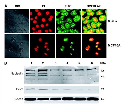 Figure 3. A, subcellular localization of nucleolin in MCF-7 and MCF-10A cells. The intracellular localization of nucleolin was determined by indirect immunofluorescence with a mAb against human nucleolin and a secondary FITC-conjugated antimouse IgG. Nuclei were counterstained with propidium iodide. Cell morphology is shown as differential interference contrast images. Representative results of three separate experiments. B, siRNA knockdown of nucleolin in stable clones of MCF-7 cells. The cells were transfected with either a scrambled siRNA (lanes 1 and 2) or a nucleolin siRNA (lanes 3–6). S10 cell extracts were prepared and the amounts of immunoreactive nucleolin, bcl-2, and β-actin proteins were determined by Western blotting.