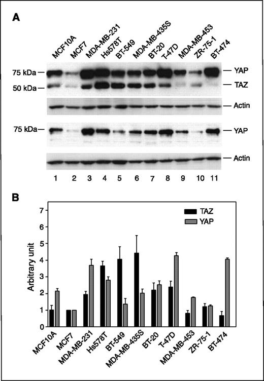 Figure 1. TAZ is preferentially overexpressed in highly invasive breast cancer cells. A, lysates derived from 11 breast cancer cell lines were analyzed by Western blot using anti-TAZ antibodies which also reacted well with YAP (top) or anti-YAP antibodies (bottom). The levels of actin as detected by anti-actin antibodies were used as loading controls. B, the expression levels of TAZ and YAP were quantified in three independent experiments and the averages were presented as arbitrary units relative to actin.