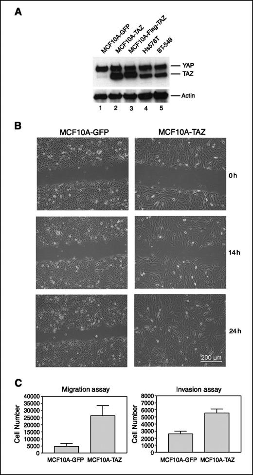 Figure 2. TAZ promotes the migration and invasion of MCF10A cells. A, the levels of TAZ in MCF10A cells transduced with retrovirus expressing EGFP (lane 1), TAZ (lane 2), or Flag-TAZ (lane 3) were assessed by Western blot. The levels of TAZ in Hs578T (lane 4) and BT-549 (lane 5) cells were assessed as comparisons. B, wound-healing migration assay for MCF10A cells expressing EGFP (left) and MCF10A cells expressing TAZ (right). The healing of wounds by migrated cells at time 0, 14, and 24 h was imaged. MCF10A cells expressing TAZ have a more motile and spindle-shaped fibroblast-like appearance and migrate faster than MCF10A cells expressing EGFP. C, the migration (left) and invasion (right) of MCF10A cells expressing EGFP and TAZ were assessed by transwell assays. Columns, mean of three independent experiments; bars, SEM.