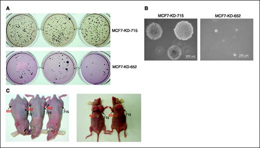 Figure 4. TAZ knockdown in MCF7 cells suppresses anchorage-independent growth in soft agar and tumorigenesis in nude mice. A, soft agar growth of MCF7-KD-715 (top) and MCF7-KD-652 (bottom) cells was assessed and photographed. B, the appearance of live colonies in soft agar of MCF7-KD-715 (left) and MCF7-KD-652 (right) cells was photographed at a higher amplification. C, tumor formation of MCF7-KD-715 (right side) and MCF7-KD-652 (left side) cells in the thigh (left) or the fat pad (right) of nude mice was assessed and photographed.