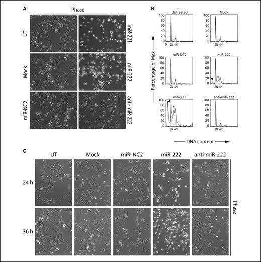 Figure 4. Ectopic expression of miR-221 and miR-222 causes cell death during serum withdrawal. A, T98G cells were transfected with miRNAs at 150 nmol/L for 24 h and then forced to enter G0 by serum deprivation. Photographs and samples for FACS analysis (see below) were taken after incubating cells in serum-free media for 72 h. Massive cell death occurs in samples transfected with miR-221 and miR-222 compared with the morphologically normal mock-transfected, NC2-transfected, and anti–miR-222–transfected cells. B, cell cycle distribution of samples taken as in A. Black lines, profiles of transfected cells. For comparison, the asynchronous T98G population is represented as gray histograms. Sub-2N (arrowhead) and S-phase accumulation (asterisk) are observed in miR-221–transfected and miR-222–transfected T98G cells. C, time course of miRNA-transfected T98G cells during serum withdrawal. Cells were transfected with miRNA oligonucleotides at 75 nmol/L for 24 h and photographed after 24 and 36 h of serum deprivation. The appearance of floating cells indicative of cell death was first observed at 24 h, which was more pronounced at 36 h and later times of serum-starvation. Increased cell death was observed only with miRNA transfection and not in anti–miR inhibitor-transfected cells. UT, untreated.