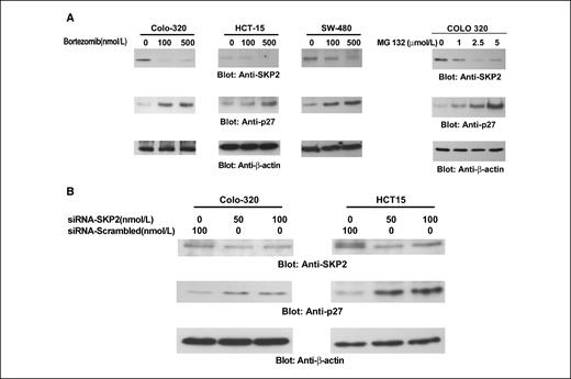 Figure 3. Down-regulation of SKP2 pathway by proteasome inhibition causes accumulation of ubiquitinated proteins and induced level of p27Kip1. A, bortezomib treatment down-regulated expression of SKP2 and increased level of p27Kip1. Colo320, HCT-15, and SW-480 cells were treated with and without 100 and 500 nmol/L bortezomib for 48 h. Colo320 cells were also treated with MG132, another inhibitor of proteasome, with indicated doses. After cell lysis, equal amounts of proteins were separated by SDS-PAGE, transferred to Immobilon membrane, and immunoblotted with antibodies against SKP2, p27Kip1, and β actin as indicated. B, SKP2 siRNA expression down-regulates SKP2 and accumulated p27Kip1. Colo320 and HCT-15 cells were transfected with scrambled siRNA (100 nmol/L) and SKP2 siRNA (50 and 100 nmol/L) with Lipofectamine as described in Materials and Methods. After 48 h of transfection, cells were lysed and equal amounts of proteins were separated by SDS-PAGE, transferred to Immobilon membrane, and immunoblotted with antibodies against SKP2, P27Kip1, and β actin as indicated.