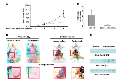 Figure 5. Bortezomib treatment inhibits growth of Colo320 xenograft and down-regulates SKP2 and increases levels of p27Kip1 in vivo. NUDE mice at 6 wk of age were injected i.p. with 5 × 106 Colo320 cells. After 1 wk, mice were treated with bortezomib at 1 mg/kg/dose or with 5% DMSO in PBS as a vehicle control. A, inhibition of Colo320 tumor growth by bortezomib. The volume of each tumor was measured every week after the start of treatment. The average (n = 5) tumor volume in vehicle-treated control mice and treated with bortezomib was plotted. *, P < 0.05. B, after 4 wk of treatment, mice were sacrificed and tumor weights were measured. *, P < 0.05 compared with vehicle-treated mice by Student's t test. C, representative tumor images of vehicle- and bortezomib-treated mice before and after necropsy. Bottom, images with ×10 magnification. D, whole-cell homogenates of individual tumor were prepared and Western blot analyses of SKP2, p27Kip1, and actin were carried out as described in Materials and Methods.