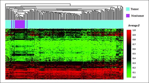 Figure 1. Unsupervised clustering of average β values in tumor and nontumor pleura. Using the R software package, normal tissue sample average β values were subjected to unsupervised hierarchical clustering based on Manhattan distance and average linkage. Each column represents a sample and each row represents a CpG locus (750 most variable autosomal loci). Above the heatmap, a tumor sample (blue) and a nontumor pleural sample (purple) are indicated. In the heat map, average β of zero, or unmethylated (green), and average β of one, or methylated (red) are shown.