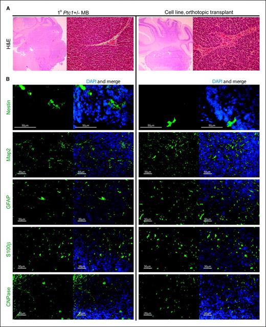 Figure 2. Primary Ptc1+/− MB (left) and tumors arising from injections of 1 × 105 MB cell lines (right) were stained with H&E (A) or 4′,6-diamidino-2-phenylindole (DAPI; B) and immunostained for the expression of Nestin, Map2, GFAP, S100β, and CNPase.