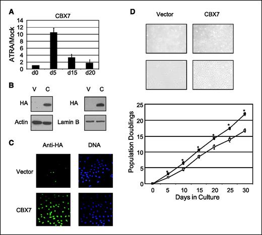 Figure 2. Stable overexpression of CBX7. A, Tera-2 cells were treated with ATRA (2 μmol/L) for days as indicated. Real-time PCR expression for CBX7 is shown relative to mock-treated cells. Columns, mean fold change for triplicates; bars, SE. B, Tera-2 cells were stably transfected with vector (V) or HA-tagged CBX7 (C). CBX7 expression is detected by anti-HA antibody at passage 4 (left) and passage 21 (right). C, anti-HA immunocytochemistry was used to detect CBX7 expression. DNA was detected by Hoescht stain. D, vector control and CBX7 overexpressing cells are shown in culture at 4× (top) and 10× (bottom) magnification. Growth curve analysis of vector control (open boxes) and CBX7 cells (solid boxes). Points, mean for triplicate wells; bars, SE. *, P < 0.05 by Student's t test.