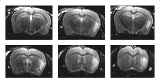 Figure 1. The complete T2-weighted series of the animal shown in the upper right panel of Fig. 6A in our report is given.