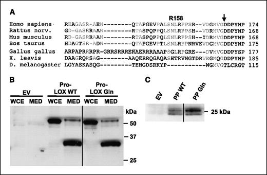Figure 1. The Arg-to-Gln substitution has no effect on protein expression, secretion, or processing. A, sequence alignment spanning the COOH terminus of LOX-PP and the NH2 terminus of the LOX enzyme. Identical amino acids in the propeptide region are in gray; arrow marks the cleavage site; amino acid numbers correspond to the last amino acid of LOX-PP shown for each species. B and C, expression of the proteins was induced in stable pools of NF639-EV (EV), -Pro-LOX WT, -Pro-LOX Gln, -LOX-PP WT (PP WT), or -LOX-PP Gln (PP Gln) cells with 2 μg/mL doxycycline for 48 h. Medium (MED) was subjected to immunoprecipitation as described. Immunoblot analysis was done on whole-cell extracts (WCE; 20 μg) and immunoprecipitates using anti-V5 antibody followed by horseradish peroxidase–labeled protein A. All lanes were from the same blots and were cut to contiguously align the relevant samples, where indicated by the solid vertical line.