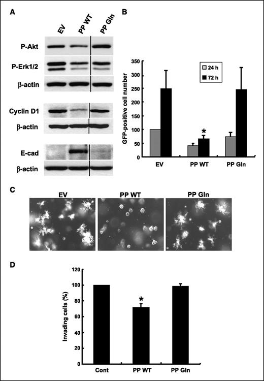 Figure 2. The LOX-PP Gln variant displays reduced ability to attenuate Her-2/neu–mediated signaling and the malignant phenotype. A, the indicated NF639 cells were treated with doxycycline for 4 h, serum starved in DMEM-0.5% FBS with doxycycline for 48 h, and stimulated with 10% FBS for 90 min for phospho-Akt (P-Akt) and phospho-Erk1/2 (P-Erk1/2) or 15 h for cyclin D1 and E-cadherin (E-cad). Whole-cell extracts (50 μg) were subjected to immunoblotting as indicated. Quantification of this and two duplicate experiments indicates that the LOX-PP WT (PP WT) and LOX-PP Gln (PP Gln) compared with EV DNA (set to 1.0) gave values for phospho-Akt of 0.67 ± 0.23 and 1.07 ± 0.12, respectively; for phospho-Erk1/2 of 0.60 ± 0.11 and 0.77 ± 0.12, respectively; and for cyclin D1 of 0.51 ± 0.17 and 0.99 ± 0.11, respectively. E-cadherin was undetectable in the NF639-EV cells, precluding analysis of fold changes compared with this sample. B, NF639 cells were cotransfected, in triplicate, with pCXbsr vector carrying the indicated cDNAs and a GFP expression vector in DMEM-0.5% FBS. The numbers of GFP-positive cells were determined 24 and 72 h after transfection by fluorescence microscopy (×50 magnification; nine fields per well). Only LOX-PP WT significantly reduced the number of GFP-positive cells (*, P = 0.009; LOX-PP Gln, P = 0.97) at 72 h after transfection as determined by Student's t test. Columns, average GFP-positive cells per image relative to EV control at 24 h (set at 100%) from three independent experiments; bars, SD. C, after induction with doxycycline for 24 h, NF639-EV, -LOX-PP WT, and -LOX-PP Gln cells were subjected to Matrigel outgrowth assay. After 5 d, cultures were photographed at ×50 magnification and representative images are shown. D, after induction with doxycycline for 24 h in DMEM-5% FBS, cells were subjected to a Matrigel invasion assay for 20 h. LOX-PP WT significantly reduced cell invasion (*, P = 0.0005) whereas LOX-PP Gln was not effective (P = 0.48). Columns, average invasion from three independent experiments relative to vehicle control (set at 100%); bars, SD.