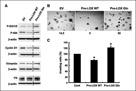 Figure 4. The G473A polymorphism impairs the ability of Pro-LOX to inhibit the transformed phenotype. A, NF639-EV, -Pro-LOX WT, and -Pro-LOX Gln cells were starved, stimulated, and analyzed as in Fig. 2A. Quantification of this and two duplicate experiments indicates that Pro-LOX WT and Pro-LOX Gln compared with EV DNA (set to 1.0) gave values for phospho-Erk1/2 of 0.91 ± 0.03 and 2.41 ± 1.20, for phospho-Akt of 0.68 ± 0.10 and 0.98 ± 0.07, for cyclin D1 of 0.71 ± 0.32 and 0.97 ± 0.27, for vimentin of 1.01 ± 0.02 and 1.61 ± 0.54, and for fibronectin (FN) of 0.91 ± 0.16 and 1.44 ± 0.36, respectively. B, cells were subjected to Matrigel outgrowth assay as described in Fig. 2C. Total colonies and colonies with branching structures were counted across nine images per sample at ×50 magnification. Numbers below represent percentage of branching colonies/total colonies from two independent experiments. C, cells were subjected to a Matrigel invasion assay as in Fig. 2D. Pro-LOX WT significantly reduced cell invasion (*, P = 2.0e−5), whereas Pro-LOX Gln significantly increased invasion of these cells (*, P = 0.002). Columns, average invasion from three independent experiments relative to vehicle control (set at 100%); bars, SD.