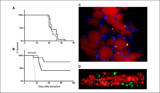 Figure 1. DIO impairs vincristine treatment. A, obese (solid line) and nonobese (dashed line) mice transplanted with 5,000 syngeneic 8093 leukemia cells and left untreated (P = 0.22). B, mice transplanted with 10,000 8093 cells and treated with 0.5 mg/kg/wk vincristine (gray bar). Solid line, obese mice (n = 12); dashed black line, control mice (n = 12); gray dotted line, vehicle-treated controls (n = 7). C, GFP+ 8093 ALL cells in the perirenal fat pad of a transplanted obese mouse that developed progressive leukemia during vincristine treatment. Lipid is stained with Nile Red, and the image is counterstained with 4′,6-diamidino-2-phenylindole. Image was taken on a Leica DM RXA2 with a ×20 objective with ×1.6 Optovar magnification (×32 final). Image is representative of fat pads obtained from the other four mice after vincristine treatment. D, GFP+ 8093 leukemia cells (green) and adipocyte feeder layer (lipid stained with Nile Red) after 48 h in coculture. Images obtained with a Zeiss LSM-510 laser scanning confocal/multiphoton microscope with a ×40 objective lens (Carl Zeiss, Inc.). Image represents Z-stack transformation (“side view”) of the adipocyte monolayer and leukemia cells (Volocity 4.3, Improvisation, Inc.).