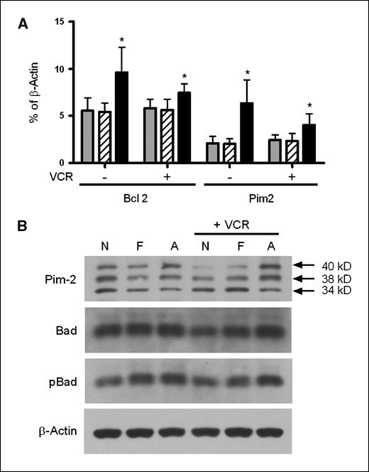 Figure 5. Effect of adipocytes on leukemia cell expression of the survival genes Pim-2 and bcl-2. A, gene expression of leukemia cells was quantified by rtPCR after 24 h of exposure to no stroma (gray columns), fibroblasts (hatched columns), or adipocytes (black bars), with or without vincristine. Results are expressed as % of β-actin gene expression. The averages and SD of five biological replicates are shown. *, P < 0.05 versus both no feeder and fibroblast layers. B, cropped Western blots of 8093 protein lysates showing the three murine isoforms of Pim-2, Bad, and phospho-S112 Bad, after exposure to no feeder layer (N), fibroblasts (F), or adipocytes (A), with or without 5 nmol/L vincristine. β-Actin is shown as a loading control. One of two representative experiments is shown. Full-length blots are in Supplementary Fig. S4.