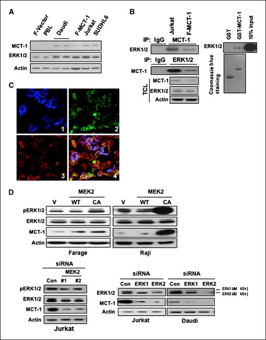 Figure 2. ERK positively modulates levels of MCT-1 protein. A, cell lysates were subjected to immunoblotting with the indicated antibodies. B, MCT-1 associates with ERK in cells. Left, Jurkat and Farage–MCT-1 cells were subjected to immunoprecipitation (IP) using either anti–MCT-1 or anti-ERK1/2 antibody, followed by immunoblotting with indicated antibodies. TCL, total cell lysate. Right, MCT-1 associates with ERK in vitro. GST-fused MCT-1 was immobilized onto GS beads and then incubated with Jurkat cell lysates. Immunoblotting was followed using anti-ERK1/2 antibody. C, colocalization between MCT-1 and ERK in human lymphoma tissues. Double immunofluorescent staining for MCT-1 (green) and ERK (red) at ×600 magnification indicates that there is strong overlapping in human lymphoma tissues. 1, 4′,6-diamidino-2-phenylindole (DAPI); 2, MCT-1; 3, ERK; and 4, merged image of MCT-1, ERK, and DAPI. D, overexpression of constitutively active (CA) MEK2 increased MCT-1 protein level. Farage or Raji cells were transfected with WT MEK2, CA MEK2 construct, or the vector control (V). The cell lysates were subjected to Western blot analysis (top). Bottom, knocking down of MEK2 and ERK1/2 decreased MCT-1 expression. Jurkat or Daudi cells were transfected with control siRNA or siRNAs specific for MEK2, ERK1, and ERK2. At 72 h after transfection, the expression of pERK1/2, ERK1/2, or MCT-1 was monitored by immunoblotting.