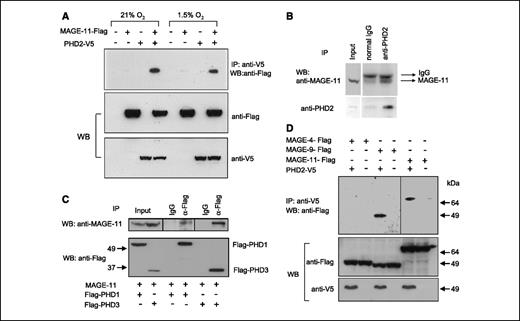Figure 1. MAGE-11 interaction with PHD2. A, Flag-MAGE-11 and V5-PHD2 were cotransfected into 293T cells and, 2 d later, treated with 1.5% oxygen or left untreated for 16 h. Immunoprecipitation was performed with anti-V5 agarose, followed by Western blotting with anti-Flag antibodies. B, coimmunoprecipitation of endogenous MAGE-11 and PHD2 from HeLa cell extracts. Protein complexes were immunoprecipitated with anti-PHD2 antibody or normal rabbit IgG, as a negative control, followed by Western blotting with anti-MAGE-11 (top) or anti-PHD2 (bottom) antibody. C, MAGE-11 was overexpressed in 293T cells with Flag-PHD1 or Flag-PHD3 and immunoprecipitated with anti-Flag or normal mouse IgG, followed by Western blotting with anti–MAGE-11 antibody. D, three different Flag-tagged MAGE-A genes were overexpressed in 293T cells alone or in combination with V5-PHD2 and immunoprecipitated with anti-V5 agarose followed by Western blotting with anti-Flag antibody.