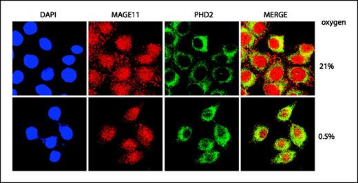 Figure 2. PHD2 colocalizes with MAGE-11 in HeLa cells. Confocal microscopy of HeLa cells exposed to 0.5% or 21% oxygen and stained with affinity purified anti–MAGE-11 rabbit antibody and anti-PHD2 mouse antibody followed by secondary anti-rabbit Alexa 568 (green fluorescence) and anti-mouse-Alexa 486 (red fluorescence) antibody.