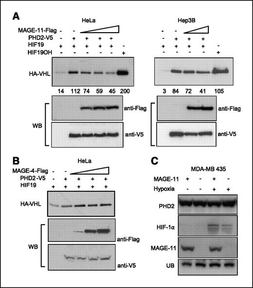Figure 3. MAGE-11 suppresses enzymatic activity of PHD2. A, V5-PHD2 and increasing amounts of Flag-MAGE-11 were coexpressed in HeLa and Hep3B cells, and 48 h later, 100 μg of protein was used to hydroxylate HIF-1α–derived 19–amino acid peptide (HIF19), followed by binding with in vitro translated HA-VHL (top). The last lanes in both panels show VHL binding to the same peptide that was chemically hydroxylated on Pro564 and served as a positive control. The numbers under the top panel show the intensity of each HA-VHL band obtained by gel densitometry. Bottom panels show that increase in MAGE-11 protein does not affect PHD2 protein levels. B, MAGE-4 does not change PHD activity when used instead of MAGE-11. C, overexpression of MAGE-11 in the MDA-MB435 cells does not change the levels of endogenous PHD2. UB, unspecific band that serves as a loading control.