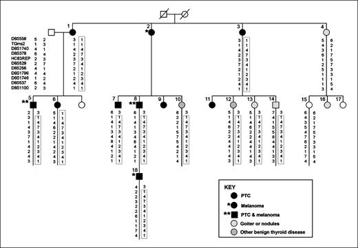 Figure 1. Haplotypes of microsatellite markers in members of family #1. A unique haplotype (boxed) cosegregates with PTC, melanoma, and some benign thyroid diseases.