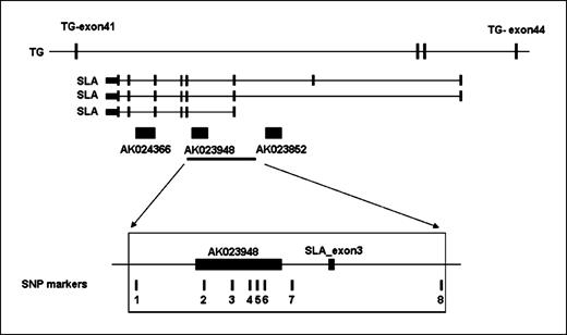 6. The thyroglobulin (TG) gene cluster and shared haplotype in the 8q24 locus. The cluster consists of the large TG gene (48 exons total); the SLA gene encoded by the opposite strand in TG introns 41, 42, and 43; and three cDNAs encoded in introns of SLA. The relative positions of the SNP markers forming a shared haplotype in nine families was based on University of Calfornia Santa Cruz Genome Browser.66. / http://genome.ucsc.edu/ The 8 SNPs forming the shared haplotype are as follows: 1, rs9942754; 2, rs2702969; 3, rs2702968; 4, rs2702967; 5, rs2739136; 6, rs17695552; 7, rs2702966; 8, rs2741205.