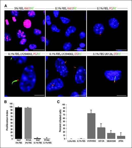 Figure 4. Preservation and reversal of ciliary assembly defect in Rink-1 pancreatic cancer cells prepared from Pdx1-Cre;LSL-KrasG12D;Ink4a/Arflox/lox tumors. A, RInk-1 cells were cultured for 48 h in the presence of FBS in the absence or presence of the indicated inhibitors (10 μmol/L each). Cells were then fixed at room temperature and stained for microscopy with antibodies to acetylated α-tubulin, detyrosinated α-tubulin (DT), and pericentrin, as indicated. Bar, 10 μm. B, proliferation indices as percentage of cells with nuclear Ki67 and PCNA nuclear positivity following a 48-h incubation with the indicated FBS concentrations. Columns, mean from three independent experiments; bars, SD. C, percent ciliated cells following a 48-h incubation in 0.1% FBS in the absence or presence of the indicated inhibitors (10 μmol/L each). Columns, mean from three independent experiments; bars, SE.