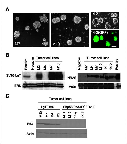 Figure 4. Characterization of cell lines derived from SB-induced tumors. A, show phase contrast image of M7 and M10 cells forming tumor spheres (left and middle). Right, 44-2 cells in phase contrast and GFP fluorescent images (bar, 100 μm). B, GL261 glioma cells were transfected with a SV40-LgT– or NRAS–encoding plasmid as a positive control or a GFP-encoding plasmid as a negative control. Western blot of cell lines derived primary tumors using anti–SV40-LgT (left) or anti-NRAS (right) antibody. C, Western blot for p53 using the indicated cell lysates.