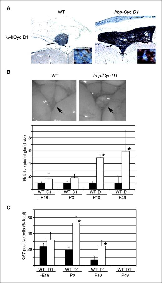 Figure 1. Pineal gland hyperplasia develops in Irbp-cyclin D1 transgenic mice. A, representative photomicrographs of the pineal gland (arrow) from P10 WT and transgenic mice following immunostaining for human cyclin D1. Original magnification, ×40 and ×400 (inset). B, representative photographs of the pineal gland (arrow) on the dorsal surface of brain (top) and quantitative analysis of pineal gland size (expressed relative to WT mice at each age; bottom) from WT and transgenic mice. C, quantitative analysis of Ki67-positive pinealocytes in WT and transgenic mice of the indicated ages. Columns, mean of measurements from three to six separate mice; bars, SD. *, P < 0.05, compared with WT.