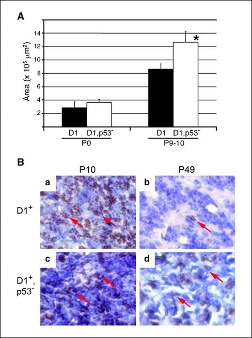Figure 3. Cyclin D1–driven cell proliferation ceases in a p53-dependent manner. A, quantitative analyses of pineal gland size in transgenic mice of the indicated ages that have (black columns) or lack (white columns) p53. *, P < 0.05. B, representative photomicrographs of pineal gland sections stained for Ki67 in transgenic mice that either retain (a and b) or lack (c and d) p53 at the ages indicated. Arrows, Ki67-positive cells.