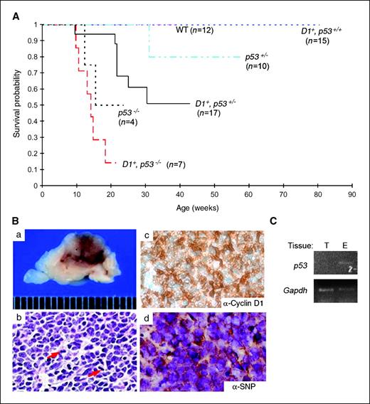 Figure 4. Pineoblastoma progression in Irbp-cyclin D1, p53−/− mice. A, Kaplan-Meier survival curves for WT (n = 12), Irbp-cyclin D1 (n = 15), Irbp-cyclin D1, p53+/− (n = 17), Irbp-cyclin D1, p53−/− (n = 7), p53+/− (n = 10), and p53−/− (n = 4) mice. The survival distributions among the Irbp-cyclin D1 mice that were p53+/+, p53+/−, and p53−/− were significantly different. B, a, representative photograph of midline sagittal section of mouse brain shows large hemorrhagic tumor. H&E staining (b) reveals numerous mitotic figures (arrows); immunohistochemical staining shows expression of human cyclin D1 (c) and a neuronal protein, synaptophysin (SNP; d). Original magnification, ×200. C, representative photo of ethidium bromide–stained agarose gel following electrophoresis of the indicated PCR products amplified from pineal gland tumor (T) or eye (E) DNA from an Irbp-cyclin D1, p53+/− mouse.
