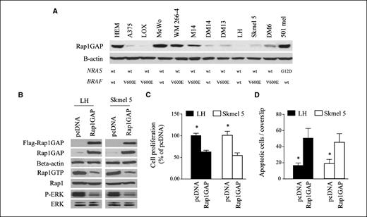 Figure 2. Overexpression of Rap1GAP decreases Rap1 activation, ERK phosphorylation, and melanoma cell proliferation and survival. A, protein was extracted from 11 melanoma cell lines and HEM, and Western blot analysis was performed for Rap1GAP; DNA extracted from the same 11 melanoma cell lines and HEM was sequenced for BRAF (exons 11 and 15) and NRAS (exons 2 and 3). The mutational status is listed under each sample, correspondingly. B, LH and Skmel 5 cells stably transfected with a pcDNA3.1 vector containing FLAG-Rap1GAP (Rap1GAP) or pcDNA 3.1 empty vector (pcDNA) were plated onto 100-mm dish for Rap1 activation assay and Western blot assay. Rap1GAP-overexpressing cells show decreased Rap1 activity and ERK phosphorylation. C, LH and Skmel 5 cells stably transfected with a pcDNA3.1 vector containing FLAG-Rap1GAP (Rap1GAP) or pcDNA 3.1 empty vector (pcDNA) were plated onto 96-well plates in selective media overnight. BrdUrd incorporation was performed for 6 h at 37°C in 5% CO2, and cell proliferation was quantitatively assessed. D, LH and Skmel 5 cells stably transfected with a pcDNA3.1 vector containing FLAG-Rap1GAP (Rap1GAP) or pcDNA 3.1 empty vector (pcDNA) were plated onto 12-mm coverslips in six-well plates. Detection of LOX cell apoptosis was performed. *, P < 0.05 for pcDNA-transfected versus Rap1GAP-transfected cells.