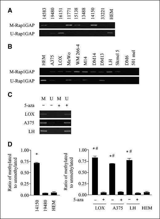 Figure 4. Down-regulation of Rap1GAP in melanoma via promoter methylation promotes melanoma cell proliferation and survival. Genomic DNA was isolated from 8 human melanoma tissues and 11 human melanoma cell lines and HEMs and subjected to MSP or quantitative DNA methylation analysis by Sequenom. A, methylation of the Rap1GAP promoter was shown in human melanoma tumors 11771, 15138, 13488, 14150, and 33221. B, methylation of the Rap1GAP promoter was shown to varying degrees in human melanoma cell lines, but not in HEM. C, LOX, A375, and LH cells were cultured in DMEM containing 10% FBS in the presence or absence of 5-aza (3 μmol/L) for 4 d with fresh medium replaced on day 2. D, the average degree of methylation of CpG units within three CpG islands of the Rap1GAP promoter in two human melanoma tumors (14150 and 19480) and three melanoma cell lines (LOX, A375, and LH cells), and HEM was quantitatively analyzed by Sequenom. Left, the average degree of methylation of the Rap1GAP promoter in tumor 14150 was significantly increased compared with HEM, whereas tumor sample 19480 showed similar relative methylation to HEM, consistent with the results by MSP; right, the average degree of methylation of the Rap1GAP promoter in LOX, A375, and LH cells was significantly increased compared with HEM, and the relative methylation of the Rap1GAP promoter was significantly reversed by 5-aza compared with 5-aza–untreated cells. M, methylated; U, unmethylated. *, P < 0.05 for tumor or melanoma cells versus HEM; #, P < 0.05 for untreated versus 5-aza–treated melanoma cell lines.