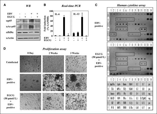 Figure 6. EGCG suppresses EBV-induced B lymphocyte transformation via inhibition of p65 acetylation. A, EGCG inhibited the EBV-mediated B-cell transformation by blocking acetylation of p65. The level of p65 acetylation was measured by Western blot analysis of the EBV-associated Burkitt's lymphoma cell lines in the presence or absence of EGCG. B, the effect of EGCG on the production of the proinflammatory cytokines IL-6 and IL-12 in EBV-positive cells was assessed by real-time PCR analysis. C, EGCG reversed the elevated cytokine expression profile in the EBV-positive B cells. Human Cytokine Antibody Array 3.0 membranes were incubated with conditioned medium from EBV-positive B cells untreated or treated with EGCG. Images were visualized using LAS 3000 image analyzer. D, EGCG inhibited the EBV-mediated B-cell transformation by blocking acetylation of p65. The outgrowth of proliferating B cells was examined by proliferation assay. Human PBMCs were incubated in the presence or absence of EBV virus obtained from induced B95.8 cells. After 3 wk of incubation, the wells were examined for the outgrowth of proliferating B cells by using phase-contrast microscopy.