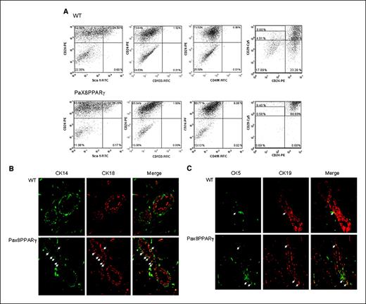 Figure 1. MMTV-Pax8PPARγ mice exhibit an increase in mammary stem and progenitor cell markers. A, fluorescence-activated cell sorting analysis of primary mammary cell cultures. Cells from MMTV-Pax8PPARγ mice (Pax8PPARγ) express an increased percentage of CD29hi/CD24− cells compared with WT mice. B, MMTV-Pax8PPARγ mice (Pax8PPARγ) express a greater percentage of CK5+ cells (arrows) than WT mice. Magnification, ×400. C, MMTV-Pax8PPARγ mice express a greater percentage of double-positive CK14/CK18 cells (arrows) compared with WT mice. Magnification, ×400.