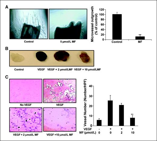 Figure 3. Morelloflavone inhibits microvessel sprouting ex vivo and angiogenesis in vivo. A, morelloflavone inhibits microvessel sprouting in mouse aortic ring assay. Approximately 1- to 1.5-mm-long cleaned mice aortic rings were placed in the Matrigel-covered wells. After 4 d of incubation with ECGM in the presence or absence of morelloflavone, representative endothelial cell sprouts forming branching cords from the margins of aortic ring were photographed and the microvessels were scored. Columns, mean (n = 4); bars, SE. *, P < 0.05; **, P < 0.01 versus control. B and C, morelloflavone inhibits angiogenesis in Matrigel plug assay. Five- to 6-wk-old C57BL/6 mice were injected with Matrigel containing VEGF and morelloflavone (2 and 10 μmol/L) in the midventral abdominal region (five mice per group). After 7 d, representative Matrigel plugs were removed and photographed in B. The Matrigel plugs were fixed with formalin and 5-μm sections were stained with H&E staining in C. The number of vessels in HPF (magnification, ×200) was counted in the presence or absence of morelloflavone at 2 and 10 μmol/L, respectively. Columns, mean (n = 4); bars, SE. *, P < 0.05; **, P < 0.01 versus VEGF alone.