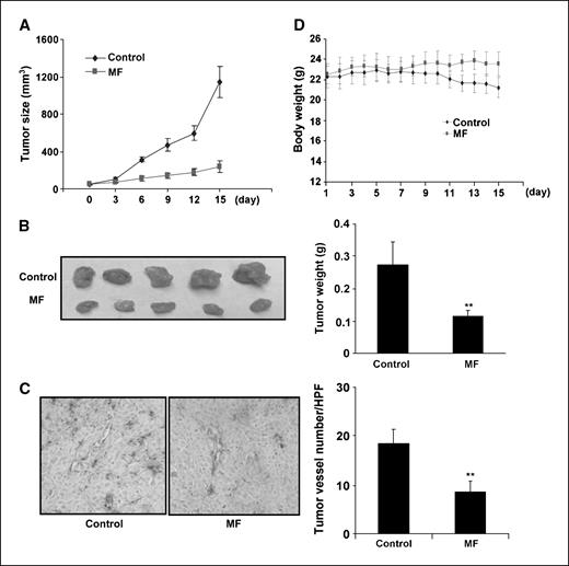 Figure 4. Morelloflavone inhibits tumor angiogenesis and tumor growth in vivo. A, morelloflavone inhibits solid cancer growth in xenograft prostate cancer mouse model. Prostate cancer cells (PC-3) were injected (2 × 106 per mouse) into the 5- to 6-wk-old SCID male mice. After the tumors had established (∼50 mm3), the mice were injected with or without 8 mg/kg/d morelloflavone. After 15 d, mice were sacrificed and tumors were removed and photographed. Tumor sizes in control group and morelloflavone group were calculated and shown in A. Tumors in control group increased from 51.18 ± 2.24 to 1,143.93 ± 75.60 mm3, whereas tumors in morelloflavone-treated group increased only from 53.80 ± 1.24 to 237.40 ± 26.75 mm3. B, solid tumors in morelloflavone-treated group were significantly smaller than the control group. The average weight of tumors from control group was 0.272 ± 0.166 g, whereas that of morelloflavone-treated group was 0.116 ± 0.183 g. C, effects of morelloflavone on tumor angiogenesis in xenograft mouse model. Solid tumors were fixed with HistoChoice MB tissue fixative and embedded with paraffin. The 5-μm sections were stained with specific blood vessel staining kit and the blood vessel number was calculated. The average vessel number in control group was 18.60 ± 1.47/HPF (magnification, ×200), whereas the average blood vessel number in morelloflavone-treated group was 8.6 ± 0.90/HPF. D, morelloflavone has little effect on mouse body weight. No significant difference between morelloflavone-treated group (8 mg/kg/d) and the control group. Columns, mean (n = 5); bars, SE. *, P < 0.05; **, P < 0.01 versus control.
