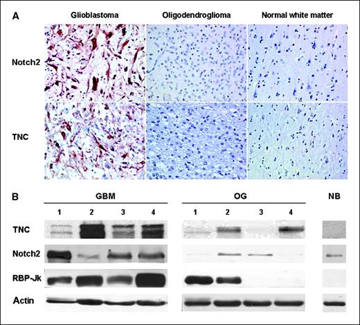 Figure 1. Notch2 and TNC expression in GBM. A, immunostaining of GBM, oligodendroglioma, and normal white matter biopsies with anti-Notch2 and anti-TNC. Notch2 and TNC stainings were performed on sections of the same biopsies. B, immunodetection of TN-C, Notch2, RBPJκ, and actin as loading control of tissue extracts of GBM, oligodendroglioma (OG), and normal brain (NB).