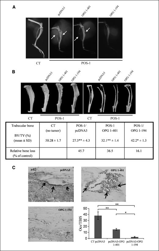 Figure 2. Higher prevention of bone lesions associated to tumor development by OPG 1-194 than OPG 1-401. A, representative radiographs of mice legs bearing osteosarcoma from each group (control, POS-pcDNA3, POS-OPG 1-401, and POS-OPG 1-194) at day 20. Arrows, tumor-induced osteolytic lesions. B, microcomputed tomography analysis and microarchitectural variables quantified at the trabecular level. BV, bone volume; TV, total volume. **, P < 0.001 (POS-pcDNA3 versus CT and POS-OPG 1-401 versus CT); *, P < 0.01 (POS-OPG 1-194 versus POS-OPG 1-401). C, TRAP-stained sections of each tibia were evaluated. Arrows, osteoclasts stained in red for TRAP activity. In the control tumor and control pcDNA3 groups, numerous osteoclasts are observed on the remaining trabeculae and within the tumor (only control pcDNA3 is shown). OPG 1-401 treatment preserved bone trabeculae more than control groups but bone lesions are still observed by the presence of TRAP-positive osteoclasts. However, OPG 1-194–treated mice showed a preserved cortical bone and complete osteoclast suppression. Osteoclast numbers at the TBIS (OcS/TBIS). **, P < 0.001; *, P < 0.01.