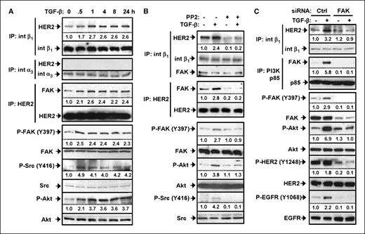 Figure 2. TGF-β activates Src-FAK, leading to receptor clustering and activation of PI3K-Akt. A, MCF10A/HER2 cells were serum starved for 16 h and treated with TGF-β for the indicated time before being subjected to immunoprecipitation with antibodies against integrin β1 and HER2. The pull-downs and whole cell lysate were subjected to immunoblot with the indicated antibodies. B, MCF10A/HER2 cells were serum starved for 16 h and pretreated with PP2 (5 μmol/L) or DMSO (vehicle control) for 1 h before being treated with TGF-β or PBS (vehicle control) for 1 h and subjected to immunoprecipitation and immunoblot. C, MCF10A/HER2 cells grown on six-well plates were transiently transfected with siRNA oligonucleotides targeting FAK or a control sequence. Seventy-two hours after transfection, cells were serum starved for 16 h and treated with TGF-β or PBS (vehicle control) for 1 h before being subjected to immunoprecipitation and immunoblot. Bands were quantified using ImageJ, with untreated cell samples (first lanes) set as 1.0.