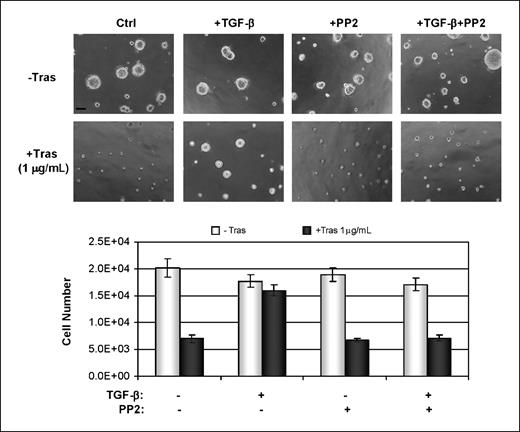 Figure 6. Inhibition of Src-FAK reverses TGF-β–induced resistance to trastuzumab. BT-474 cells were plated in Matrigel in eight-well chambers and allowed to grow in the absence or presence of TGF-β (2 ng/mL) and PP2 (1 μmol/L) as indicated. Trastuzumab was added to the top medium 12 h after cell seeding. The inhibitors were replenished every 3 d. Phase-contrast images shown were recorded 9 d after the initial seeding of cells. Bar, 50 μm. Bottom, 9-d acini were trypsinized and total cell number was determined. Columns, mean of four wells; bars, SD.