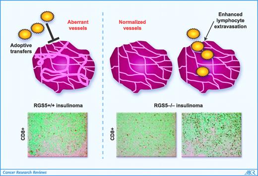 Figure 1. Responsiveness to immunotherapy is dramatically increased in RGS5-deficient tumors. Wild-type RIP1-Tag5 insulinomas display a chaotic vascular network, which is shared with many human tumors. Activated, antitumor lymphocytes after adoptive transfer fail to penetrate into tumor parenchyma. In contrast, tumors arising in a RGS5-deficient background show a homogeneous, normalized network of blood vessels. This enables enhanced infiltration of tumor-specific effector cells and subsequently leads to tumor eradication (10). Staining for CD8+ T cells in RGS5+/+ and RGS5−/− tumors is shown. Counterstain with methyl green. Magnification, ×10.